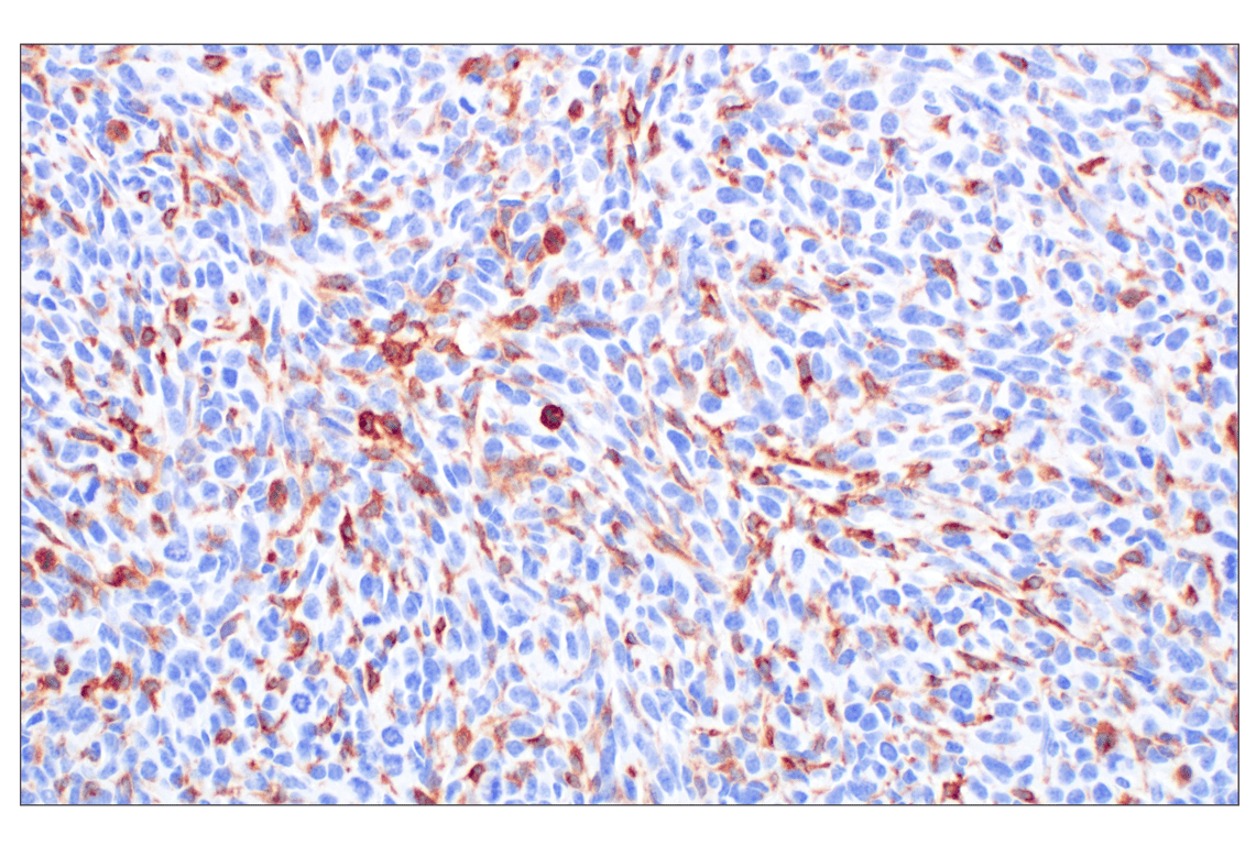 CSF-1R/M-CSF-R (F1H1I) Rabbit Monoclonal Antibody | Cell Signaling