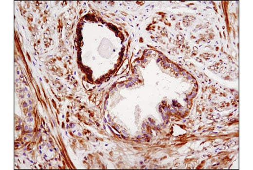 Immunohistochemistry Image 2: Phospho-EphA2 (Ser897) (D9A1) Rabbit Monoclonal Antibody (BSA and Azide Free)