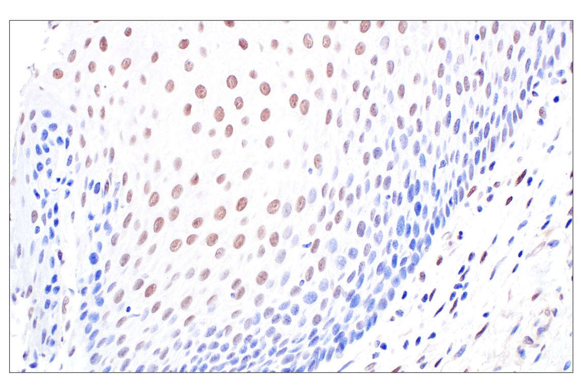 Immunohistochemistry Image 6: TFE3 (F3Z2Q) Rabbit Monoclonal Antibody