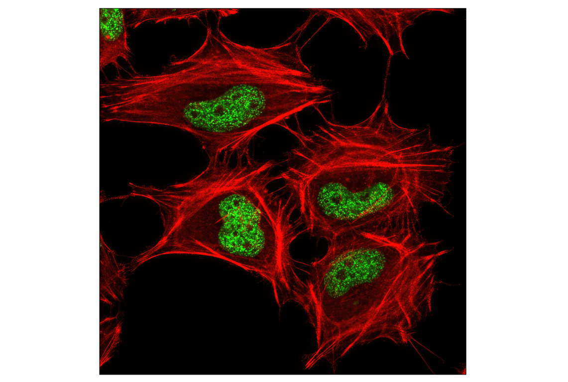 Immunofluorescence Image 1: Tri-Methyl-Histone H3 (Lys27) (C36B11) Rabbit Monoclonal Antibody (BSA and Azide Free)