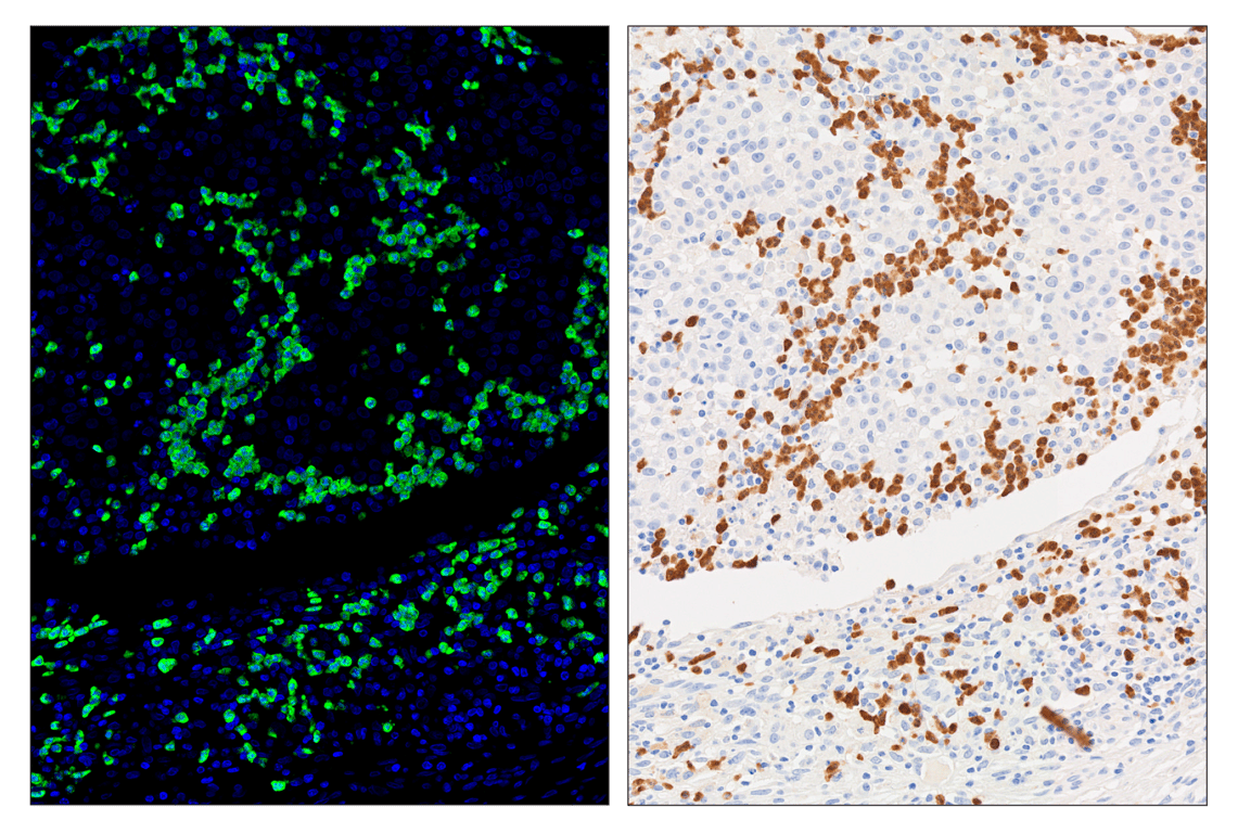 Immunohistochemistry Image 5: Arginase-1 (D4E3M) & CO-0075-750 SignalStar<sup>™</sup> Oligo-Antibody Pair