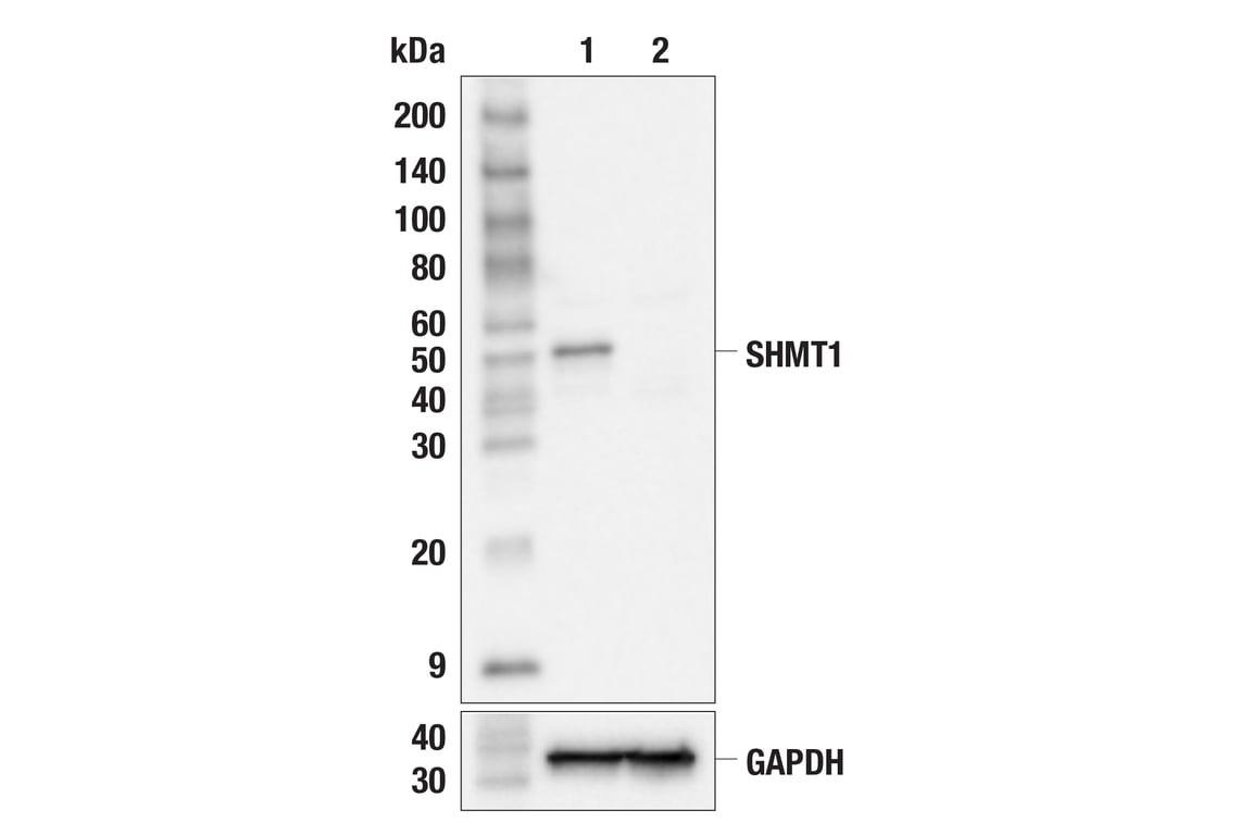 Western Blotting Image 2: SHMT1 (F5Q3S) Rabbit Monoclonal Antibody