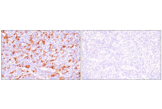 Immunohistochemistry Image 4: GM-CSF Receptor alpha (E8Z3S) Rabbit Monoclonal Antibody