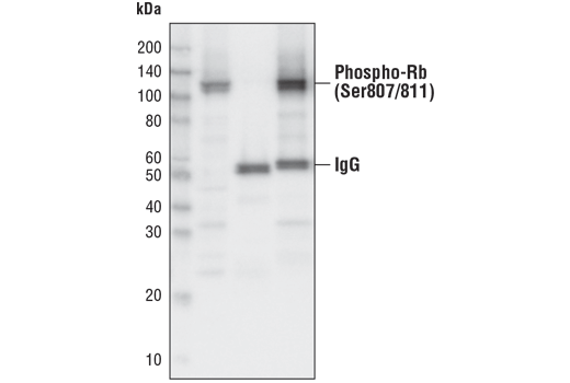 undefined Image 12: Rb Antibody Sampler Kit