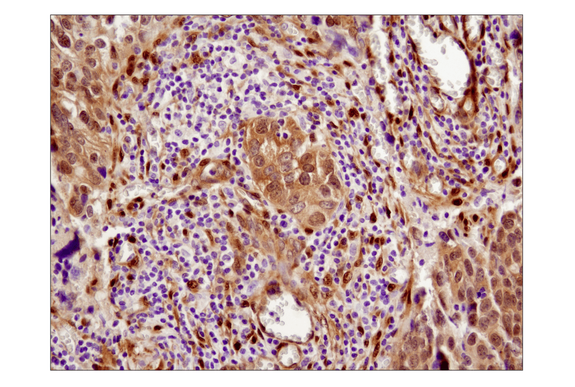 Immunohistochemistry Image 2: YAP (1A12) Mouse Monoclonal Antibody (BSA and Azide Free)