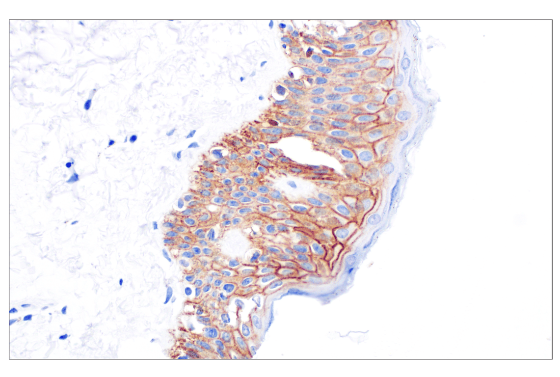 Immunohistochemistry Image 8: CD44 v5 (C44Mab-3) Mouse Monoclonal Antibody