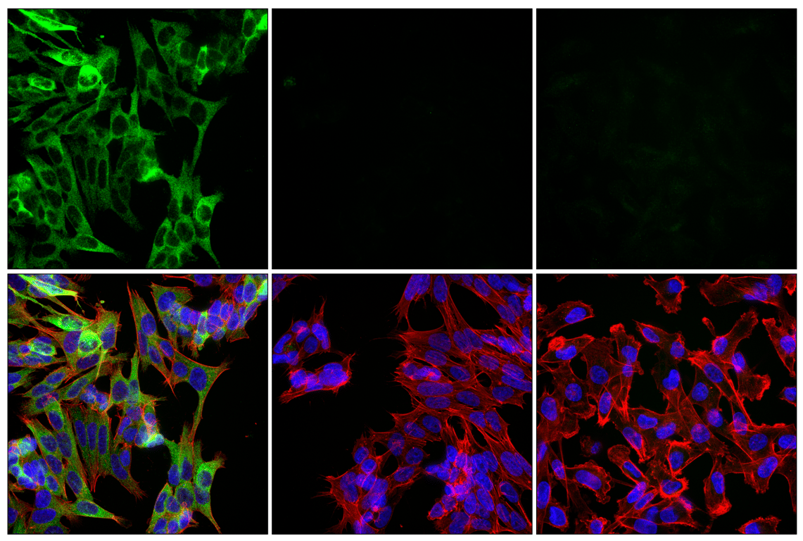 Immunofluorescence Image 1: Phospho-Tau (Ser396) (F3S9T) Rabbit Monoclonal Antibody