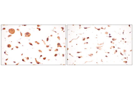 Immunohistochemistry Image 12: B-Raf (E3T5C) Mouse Monoclonal Antibody (BSA and Azide Free)