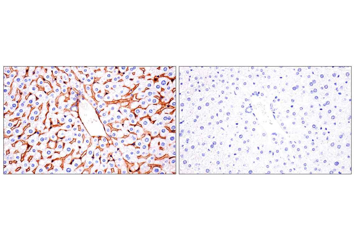 Immunohistochemistry Image 10: CD81 (D5O2Q) Rabbit Monoclonal Antibody
