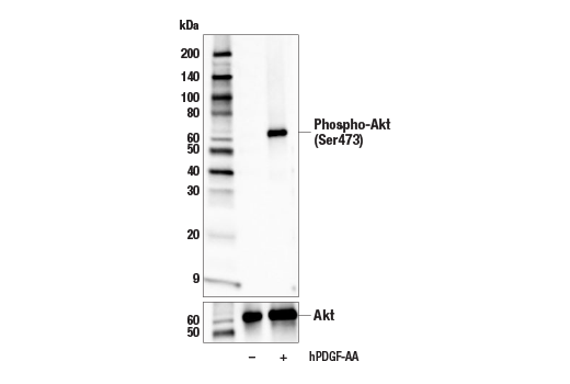 Western Blotting Image 3: Phospho-Akt (Ser473) (E4U3U) Mouse Monoclonal Antibody
