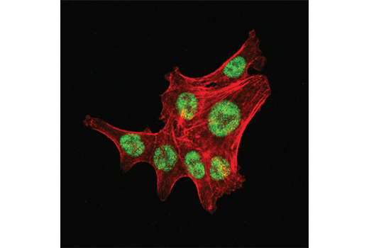 Immunofluorescence Image 2: LRF/Pokemon (D7U2O) Rabbit Monoclonal Antibody