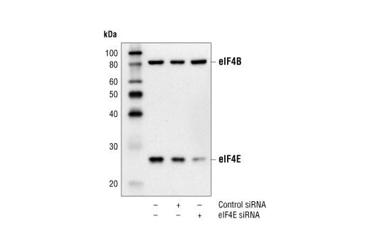 undefined Image 2: SignalSilence<sup>®</sup> eIF4E siRNA I