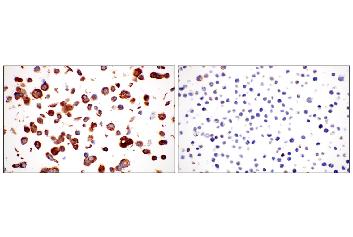Immunohistochemistry Image 11: Desmoplakin (F3J8Y) Rabbit Monoclonal Antibody