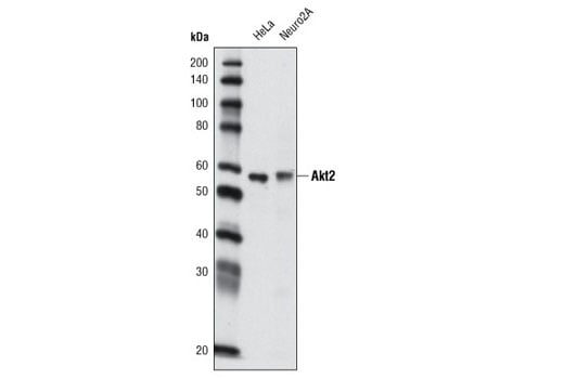 Western Blotting Image 2: Akt2 (L79B2) Mouse Monoclonal Antibody
