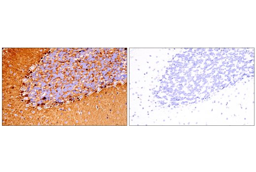 Immunohistochemistry Image 5: S100B (E9F2I) Rabbit Monoclonal Antibody