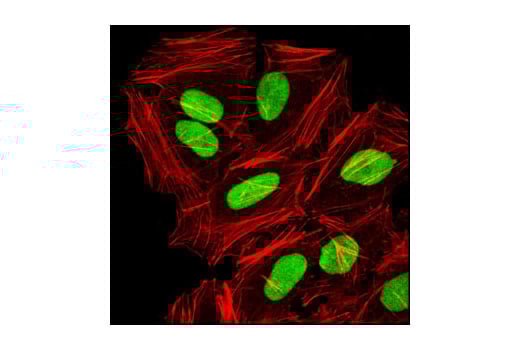 Immunofluorescence Image 1: CTCF (D31H2) Rabbit Monoclonal Antibody (BSA and Azide Free)