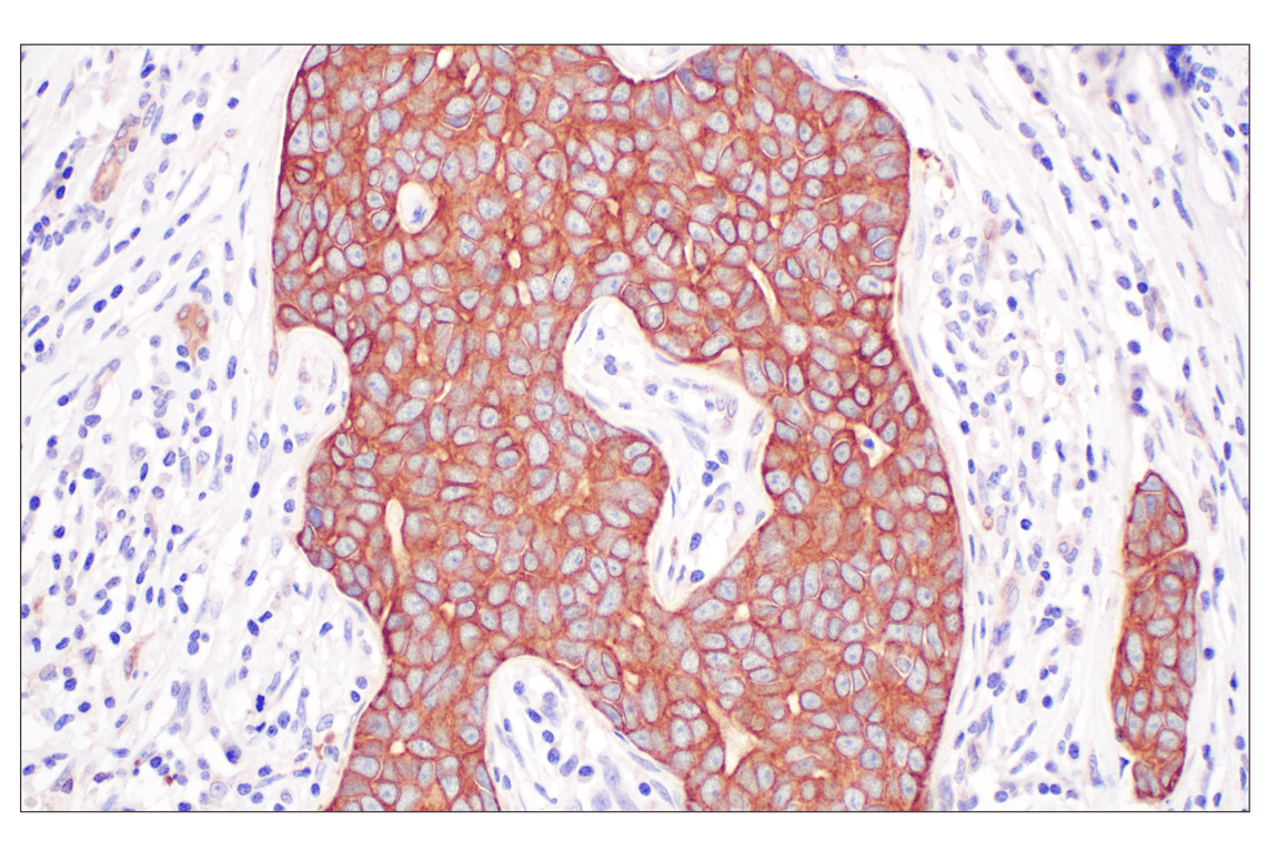 Immunohistochemistry Image 1: Desmoplakin (F3J8Y) Rabbit Monoclonal Antibody