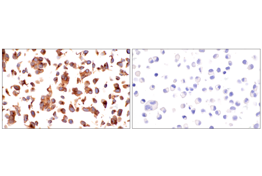 Immunohistochemistry Image 9: Rab27B (E4V3O) Rabbit Monoclonal Antibody