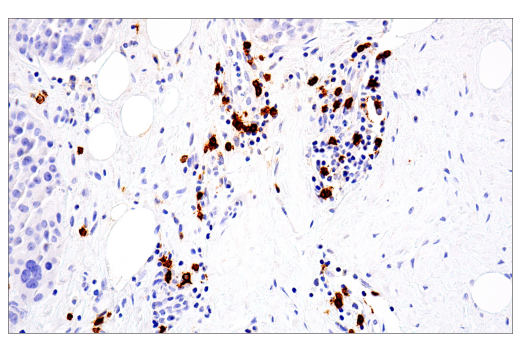 Immunohistochemistry Image 1: CD20 (L26) Mouse Monoclonal Antibody