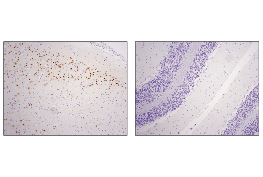 Immunohistochemistry Image 4: TBR1 (D6C6X) Rabbit Monoclonal Antibody (BSA and Azide Free)