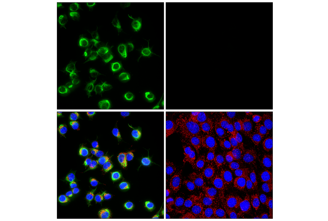 Immunofluorescence Image 1: Peripherin (F3J1R) Rabbit Monoclonal Antibody