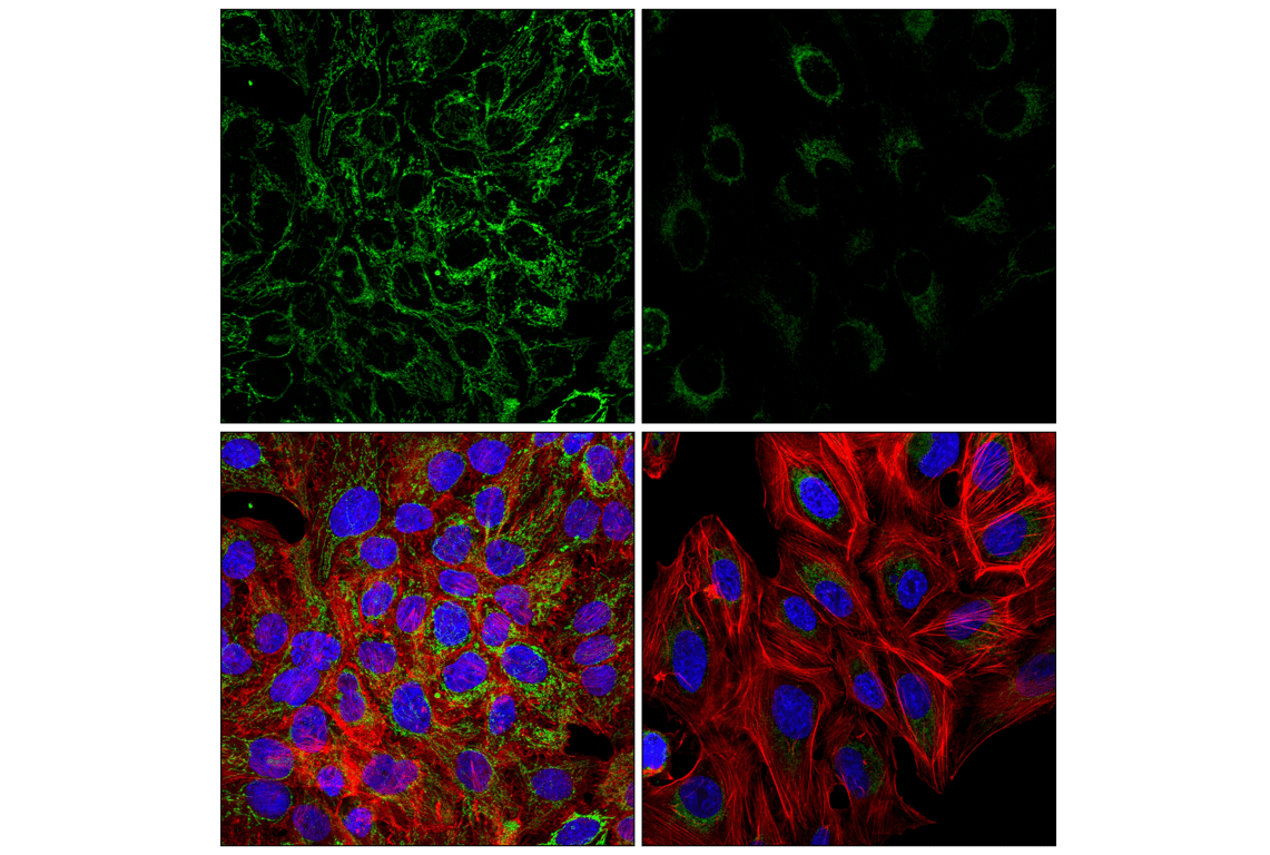 Immunofluorescence Image 1: PITRM1 (F2Y2T) Rabbit Monoclonal Antibody