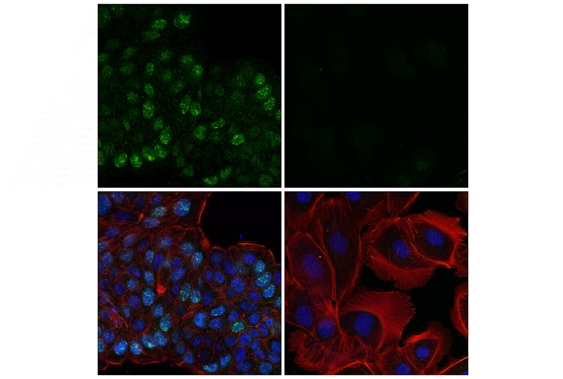 Immunofluorescence Image 1: BRCA1 (E5S9G) Rabbit Monoclonal Antibody