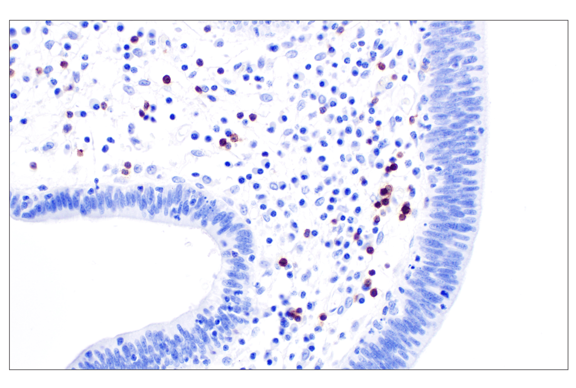 Immunohistochemistry Image 6: CCR4 (F9A9K) Rabbit Monoclonal Antibody