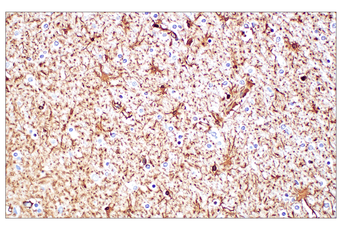 Immunohistochemistry Image 7: GFAP (E4L7M) Rabbit Monoclonal Antibody