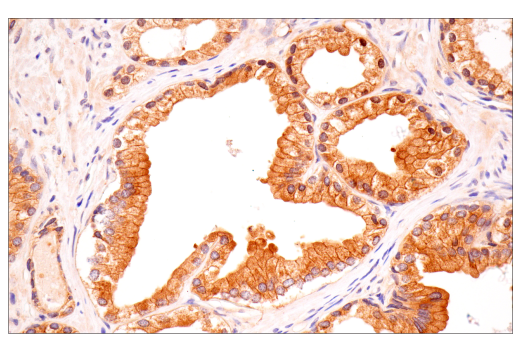 Immunohistochemistry Image 2: B-Raf (E3T5C) Mouse Monoclonal Antibody