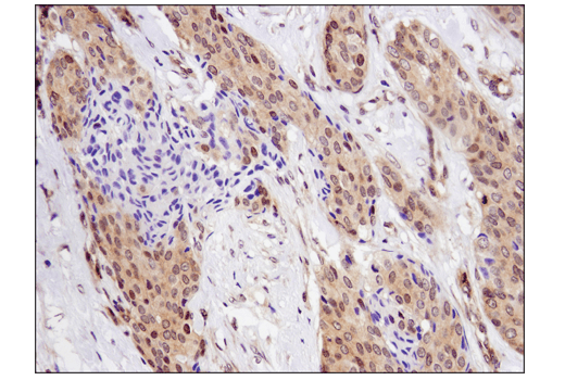 Immunohistochemistry Image 2: SMAD4 (D3R4N) Rabbit Monoclonal Antibody