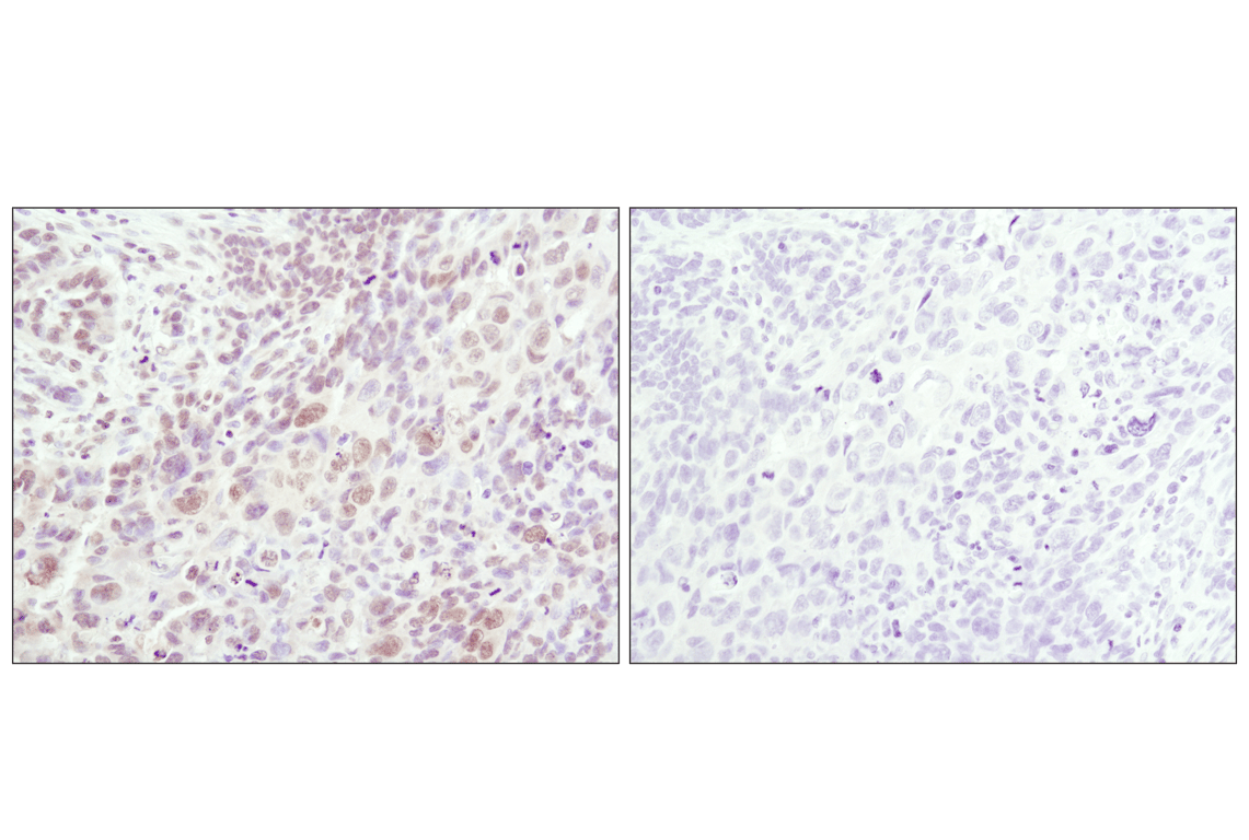 Immunohistochemistry Image 2: Phospho-SAPK/JNK (Thr183/Tyr185) (81E11) Rabbit Monoclonal Antibody
