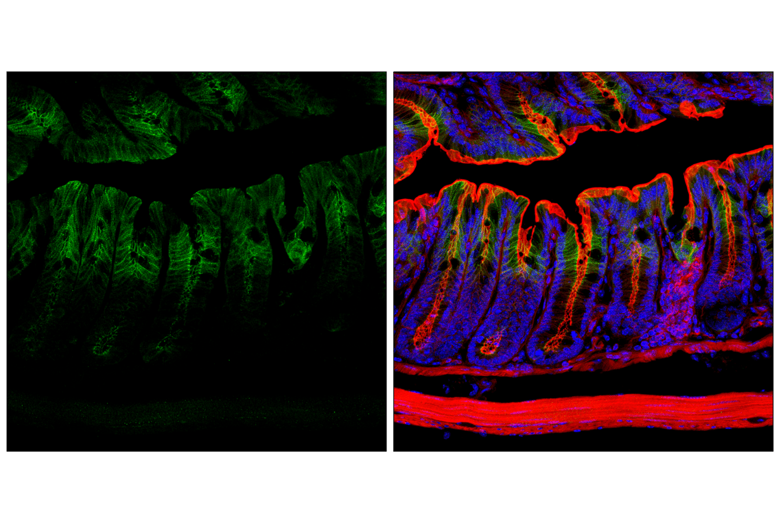 Immunofluorescence Image 2: Desmoplakin (F3J8Y) Rabbit Monoclonal Antibody