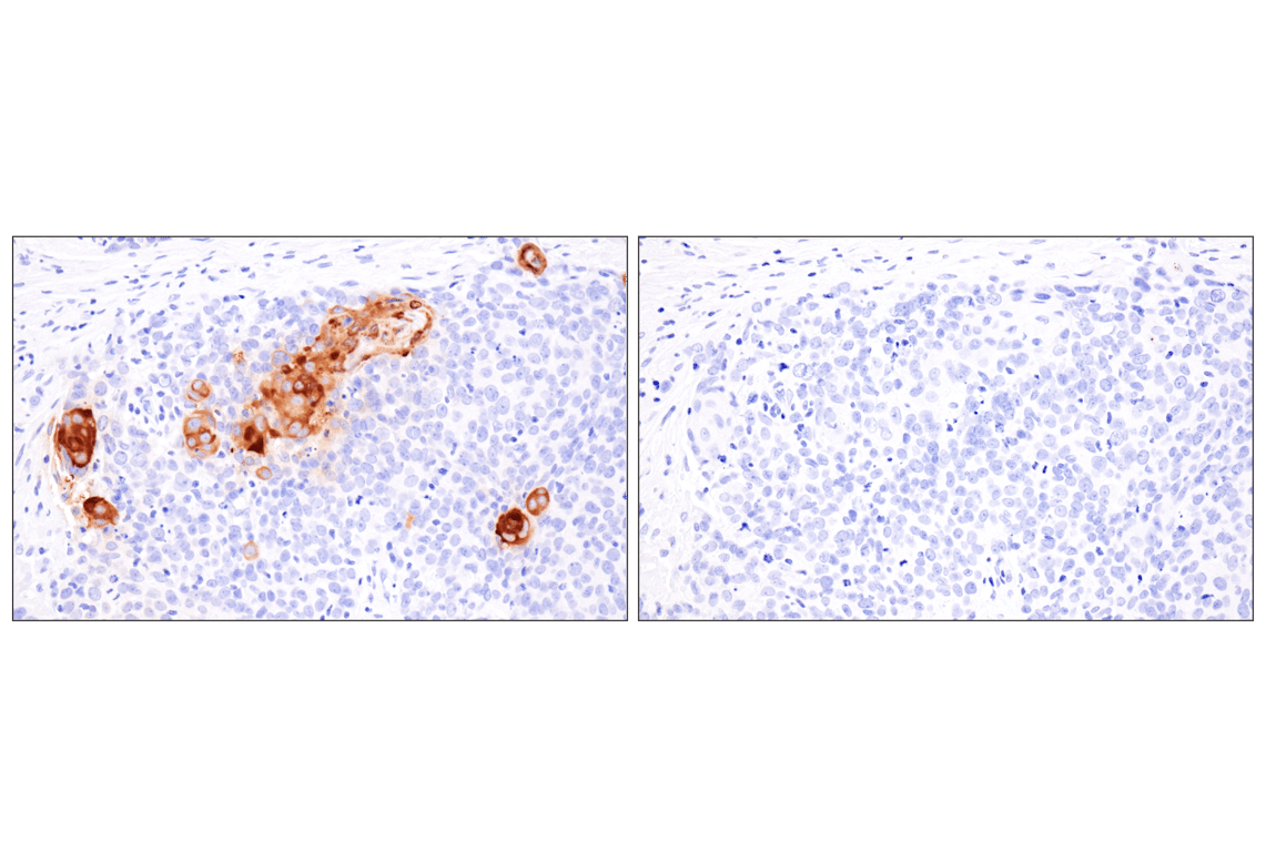 Immunohistochemistry Image 9: Involucrin (F9C3C) Rabbit Monoclonal Antibody