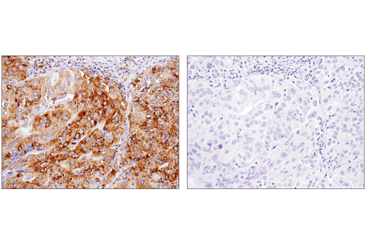 Immunohistochemistry Image 4: MX1 (D3W7I) Rabbit Monoclonal Antibody