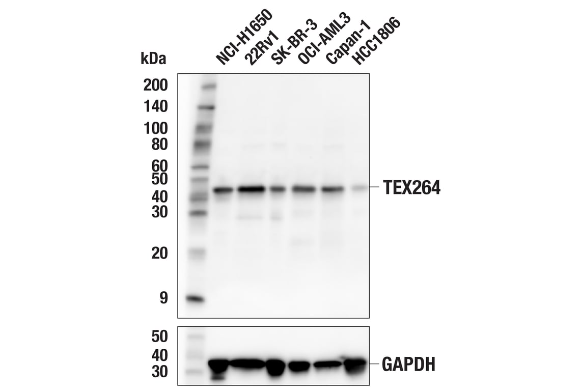 undefined Image 3: ER-phagy Cargo Receptor Antibody Sampler Kit