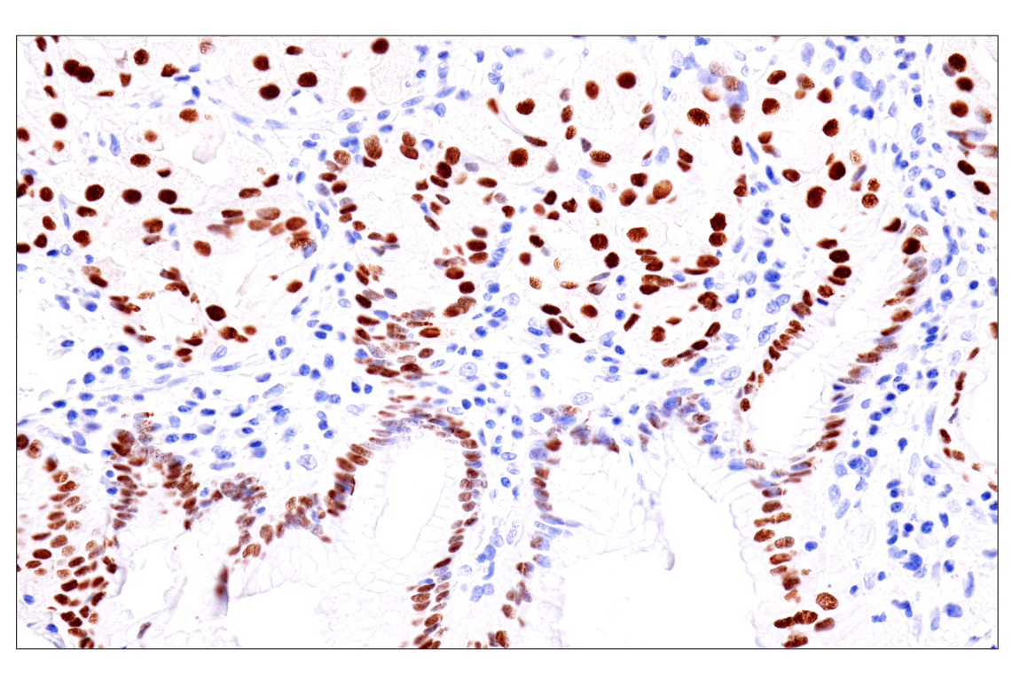 Immunohistochemistry Image 8: GATA-6 (D61E4) XP<sup>®</sup> Rabbit mAb (BSA and Azide Free)