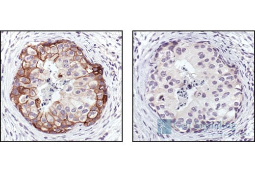 Immunohistochemistry Image 2: Phospho-EGF Receptor (Tyr1173) (53A5) Rabbit Monoclonal Antibody