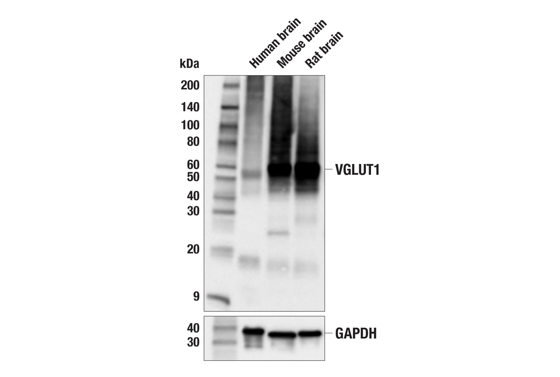 Western Blotting Image 1: VGLUT1 (E9D2B) Mouse mAb