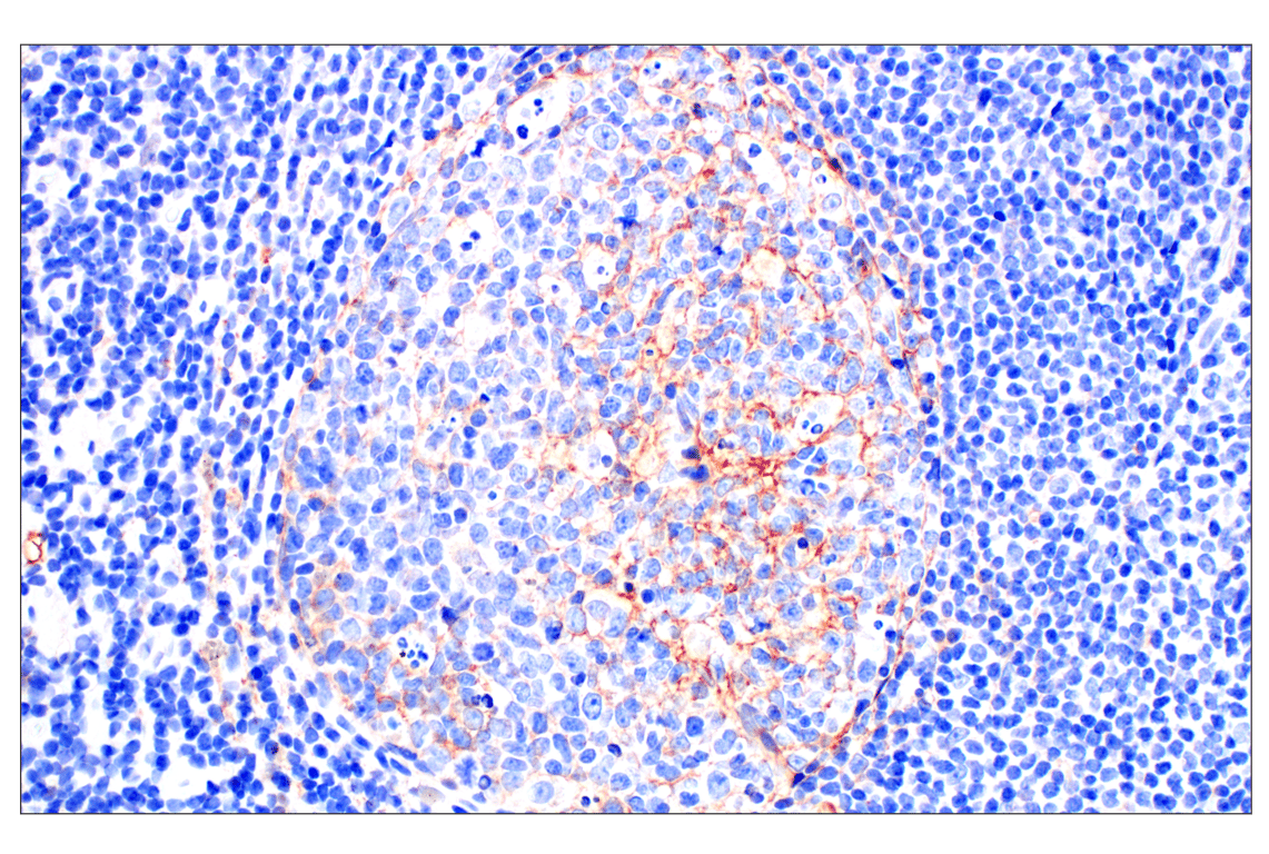 Immunohistochemistry Image 7: Neuropilin-2 (E5Q2G) Rabbit Monoclonal Antibody
