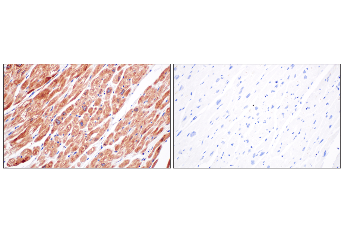 Immunohistochemistry Image 12: EEA1 (E9Q6G) Mouse Monoclonal Antibody