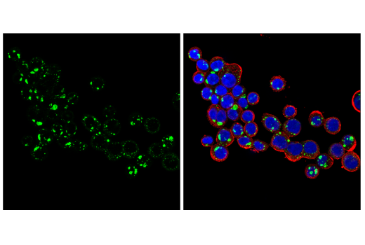 Immunofluorescence Image 2: NBR1 (E6Q3F) Rabbit Monoclonal Antibody