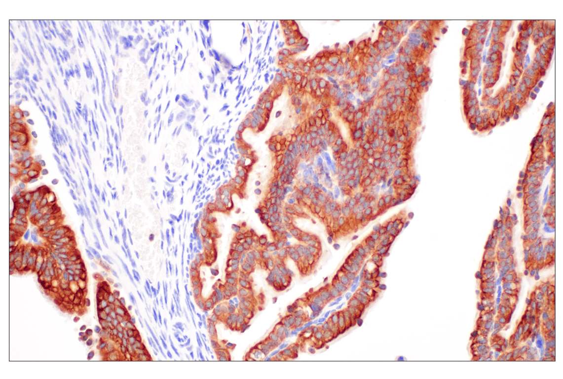 Immunohistochemistry Image 8: Desmoplakin (F3J8Y) Rabbit Monoclonal Antibody