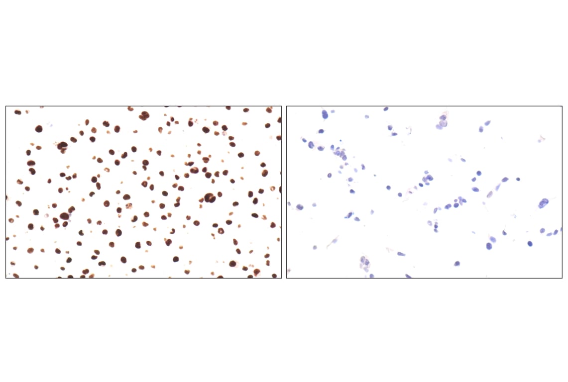 Immunohistochemistry Image 12: BATF3 (E3F3L) Rabbit Monoclonal Antibody
