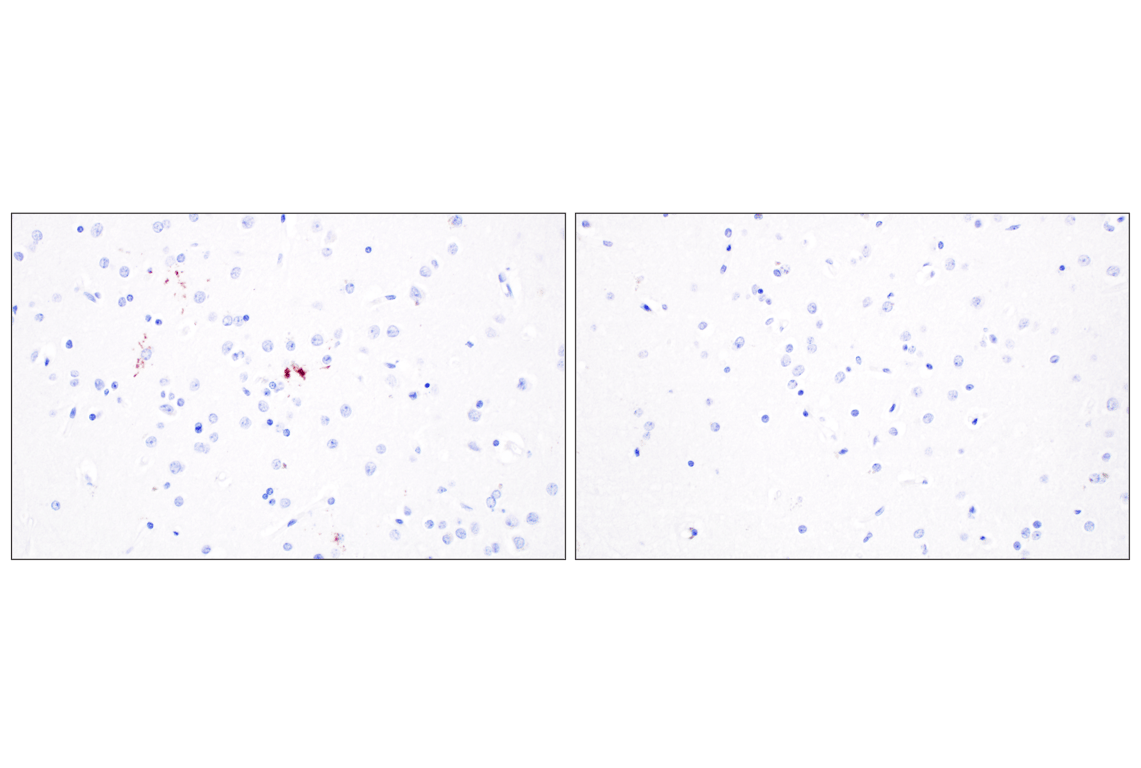 Immunohistochemistry Image 4: Phospho-TDP43 (Ser409/Ser410) (F9S3F) Rabbit Monoclonal Antibody