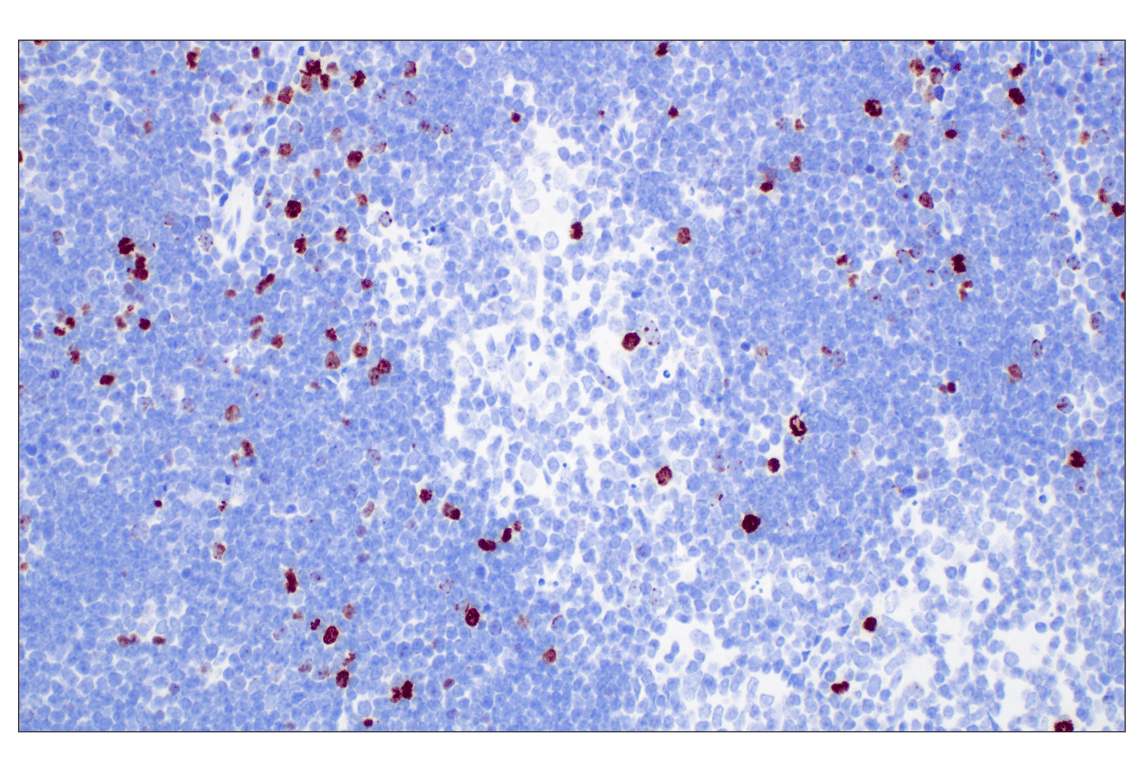 Immunohistochemistry Image 12: Phospho-Histone H3 (Ser10) (D7N8E) Rabbit Monoclonal Antibody