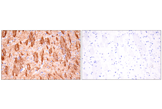 Immunohistochemistry Image 6: Neurofilament-H (E7Z7G) Rabbit Monoclonal Antibody (BSA and Azide Free)