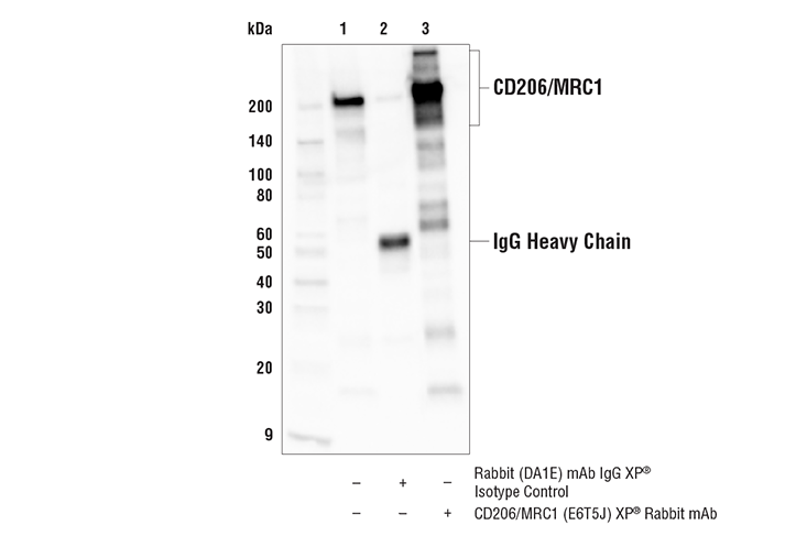 Immunoprecipitation Image 1: CD206/MRC1 (E6T5J) Rabbit Monoclonal Antibody