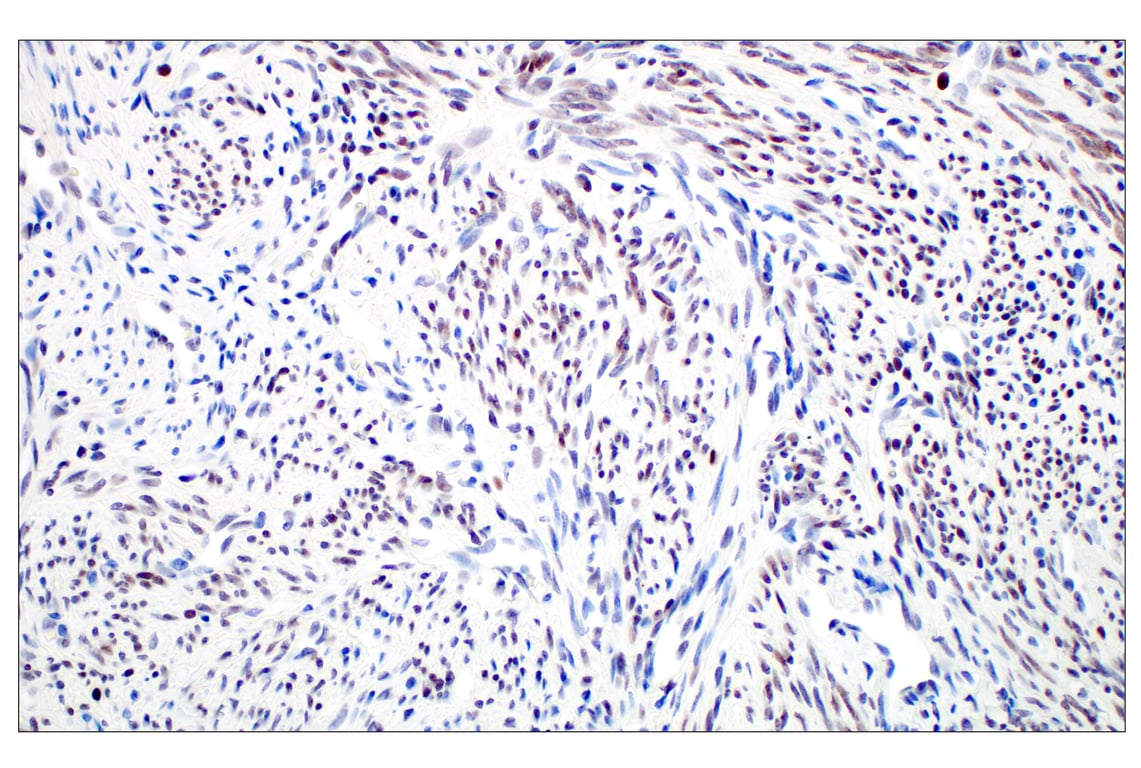 Immunohistochemistry Image 4: GATA-2 (E8B5C) Rabbit Monoclonal Antibody (BSA and Azide Free)