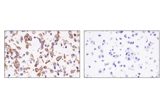 Immunohistochemistry Image 2: CD200 (E5I9V) Rabbit Monoclonal Antibody (BSA and Azide Free)